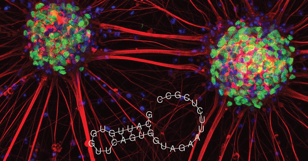 Op zoek naar nieuwe antiepileptica UMC Utrecht